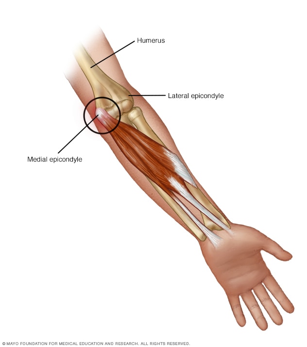 two-exercises-help-pain-when-elbow-is-bent-or-straightened-excel